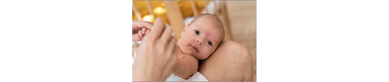 Milky Cradle Cap