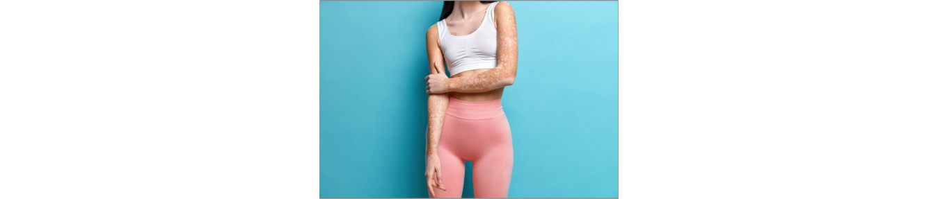 Psoriasis, Xerosis atau Keratosis Pilaris