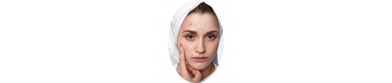Faccia oleosa per pelle/acne